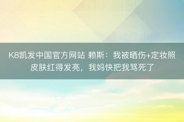 K8凯发中国官方网站 赖斯：我被晒伤+定妆照皮肤红得发亮，我妈快把我骂死了